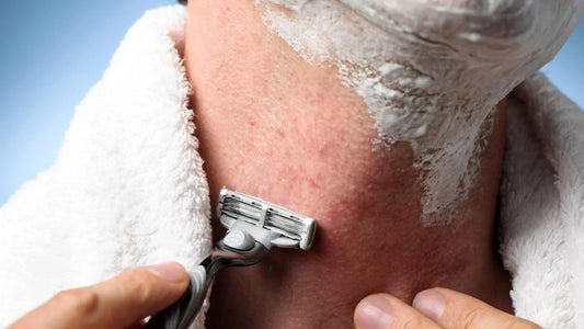 How to Get Rid of Razor Bumps Fast: 10 Proven Tips for Smooth, Bump-Free Skin