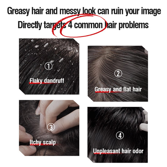 KWAN YEE GOR Caffeine Shampoo for Hair Loss & Dandruff - KWAN YEE GOR